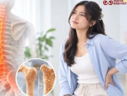 Merasa Sehat? Belum Tentu Tulangmu Kuat Osteoporosis Bukan Cuma untuk Lansia